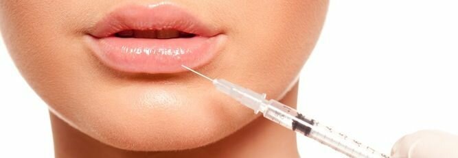 Увеличение губ гиалуроновой кислотой: отзывы